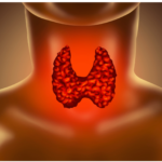 ADHD and Thyroid Problems